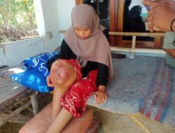 Mahasiswi IAIN Madura Diduga Derita Kanker Ganas, Keluarga Kesulitan Biaya