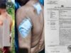 Kecam Penganiayaan Berat di Caringin Bogor, Wilson Lalengke Desak Kepolisian Tangkap Pelaku