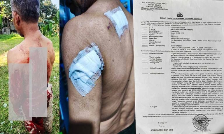 Kecam Penganiayaan Berat di Caringin Bogor, Wilson Lalengke Desak Kepolisian Tangkap Pelaku